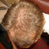 before.jpg