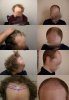 Before and after web.jpg