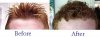 hair-before-and-after.jpg