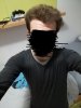 hair loss 1.jpg