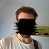 hair loss 2.jpg