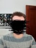 hair loss 3.jpg