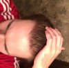 hairloss april.jpg