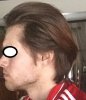 hairloss2.jpg