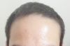 front.png