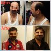 HaiReal Customer Pic2_Before&After.jpg