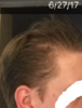 6-27-17 left.png