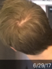 6-29-17 crown.png