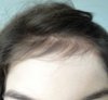 Regrowth1.jpg