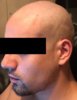 Before.jpg