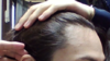RightSideBefore.png