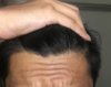 Front hair line 4.jpeg