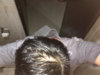 Top (wet with minoxidil) 4.jpg