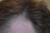 left_closeup.jpg