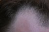 right_closeup.jpg