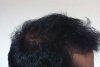 uk-resp-8months-rightt.jpg