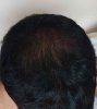 uk-resp-8months-crown.jpg