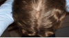 Crown - Angle 1.gif