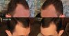 temples_3_months_combed.jpg