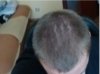 scalp.jpg