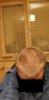 scalp2.jpg