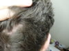 back dry.JPG