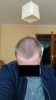 september 2017 scalp 2.jpg