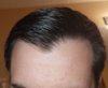 20171126_231545.jpg