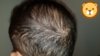 20171210_045619.jpg