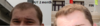 dutasteride vs finasteride.png