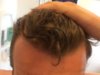 frontal.jpeg