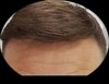 Phil_Hair_7months.jpg