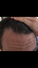 4643B9C2-4BBD-4A7A-B3DA-6B0748F948FA.png