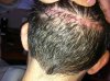Scar pic 1.jpeg