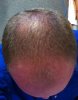 HairPic2wk.jpg