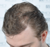 hairline.png
