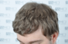 dry hair.png