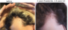 my hair gains.png