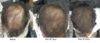 hair loss.jpg hair loss.jpg