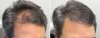 1363__500x192_medications_patient-adq.jpg 1363__500x192_medications_patient-adq.jpg