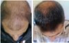 before-after-image.jpg