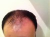 hairfall 3.jpg