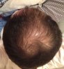 hairfall.jpg