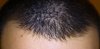 minoxidil.jpg