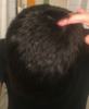 Scar.png