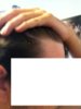 Right side.jpg
