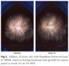 (Olsen et al., 2007) Fig. 3.png