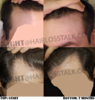 hairline.png