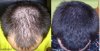 beforeandafter.jpg