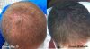 Crown10MonthCompare.jpg Crown10MonthCompare.jpg